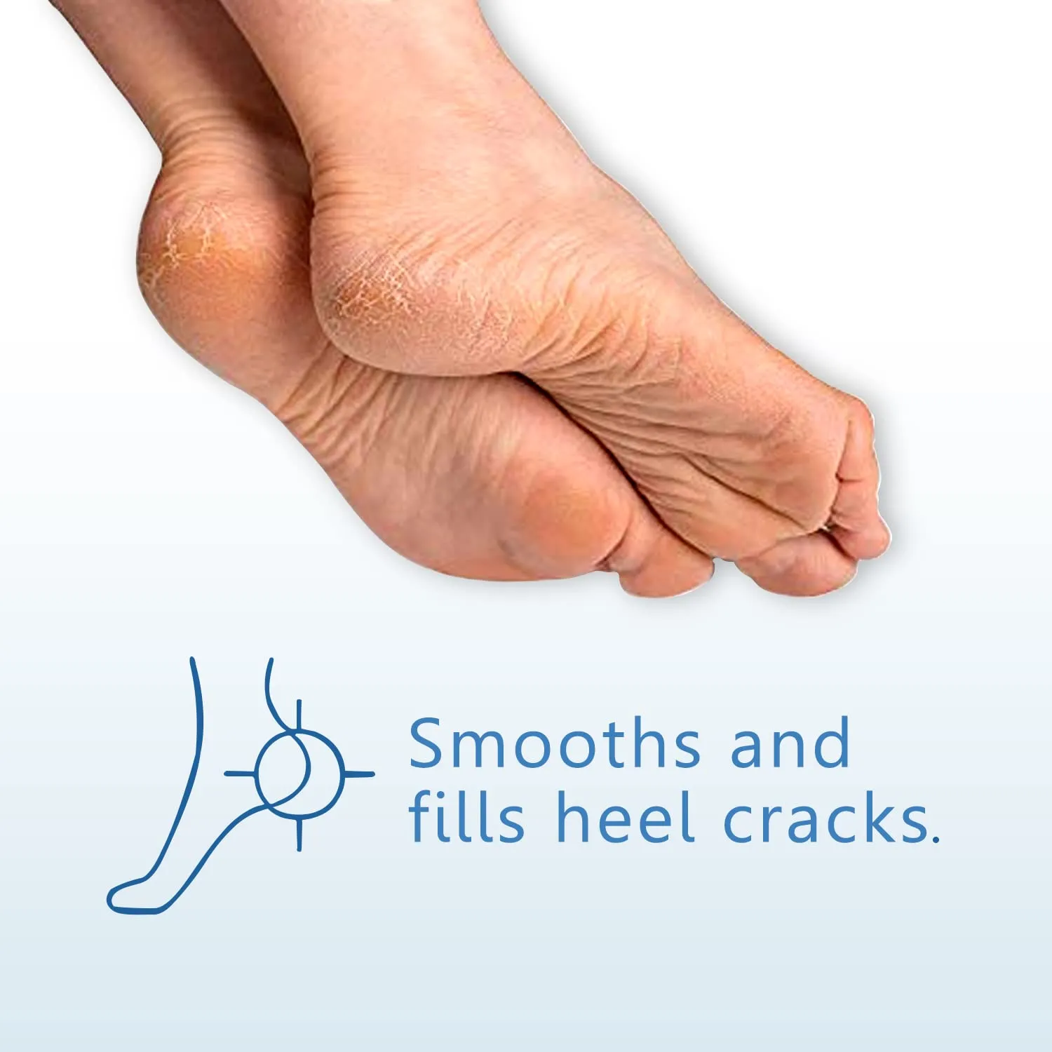 Dr Foot Cracked Heel Balm with Urea, Aloe Vera Gel & Tea Tree Oil for Rough, Thick, Dry, Cracked Skin | Cure and Moisturizes for Healthy Feet – 50gm